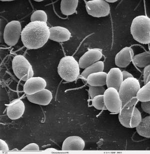 electron microscope image
